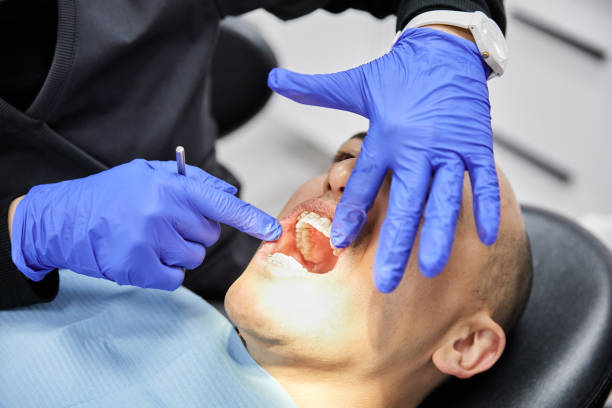 Best Emergency Dentist for Knocked-Out Tooth in Riverside, AL